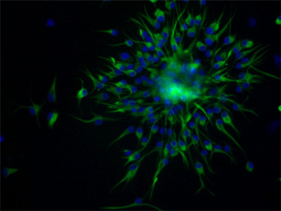 穩(wěn)轉(zhuǎn)株篩選與鑒定