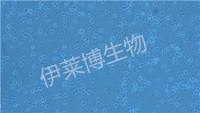 神經(jīng)元原代培養(yǎng)